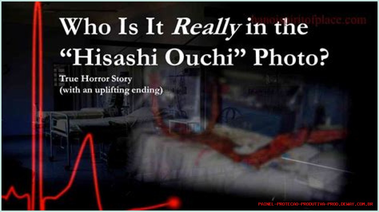 Unveiling The Tragic Story Behind Hisashi Ouchi Hospital Photos